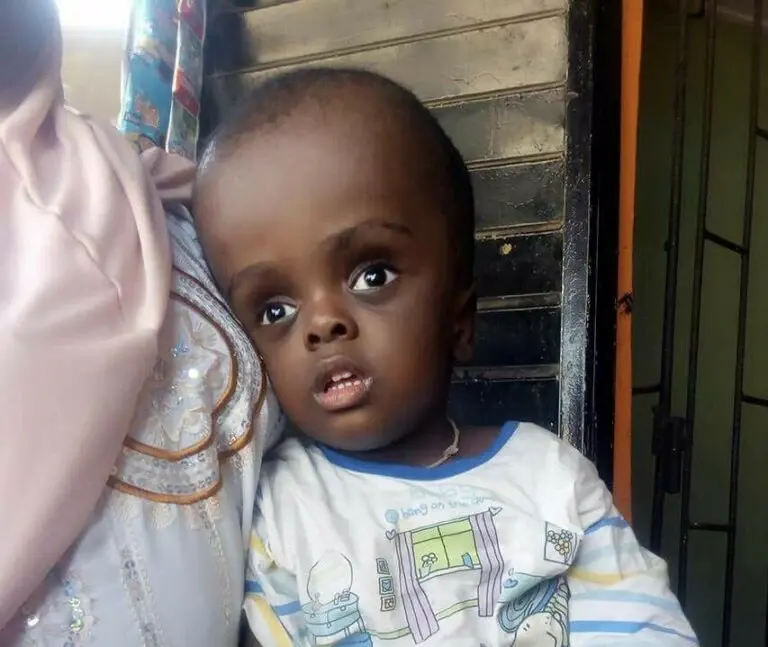 A child supported by Hourera’s medical relief programme